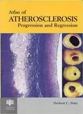 An Atlas of Atherosclerosis Progression and Regression